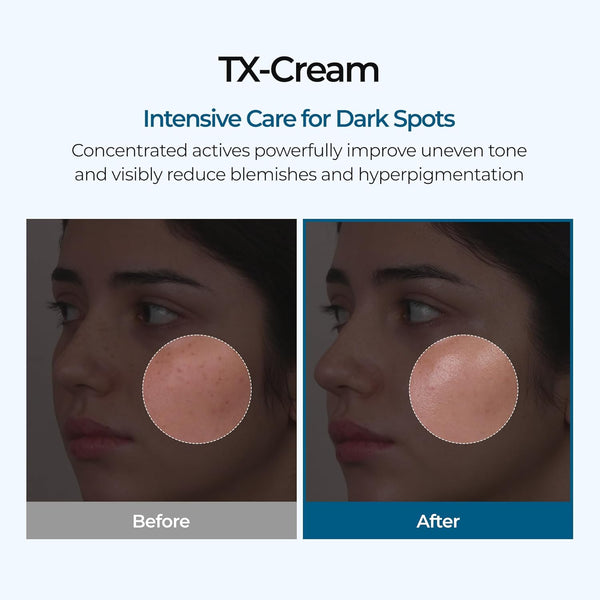 Radiant Glow Freckle Cream