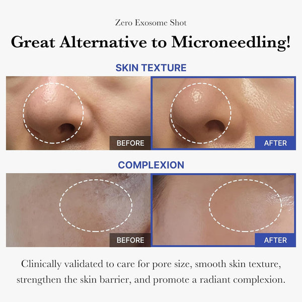 Pore Perfecting Skin Pads